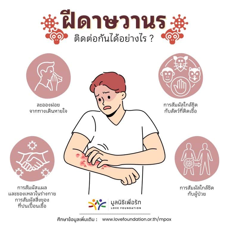 อินโฟกราฟิก Mpox แผ่นที่ 3