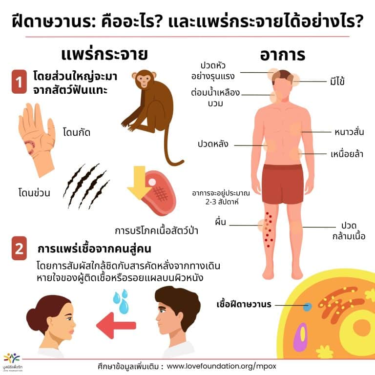 อินโฟกราฟิก Mpox แผ่นที่ 4