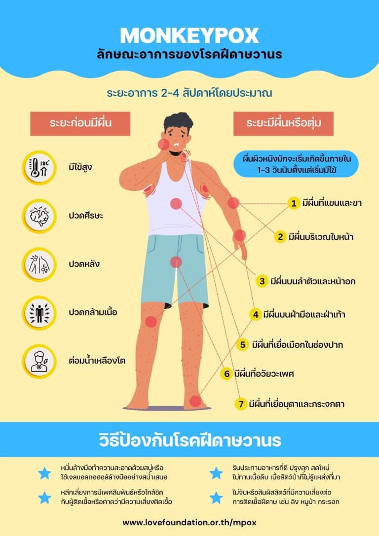 โปสเตอร์ความรู้ Mpox แผ่นที่ 4