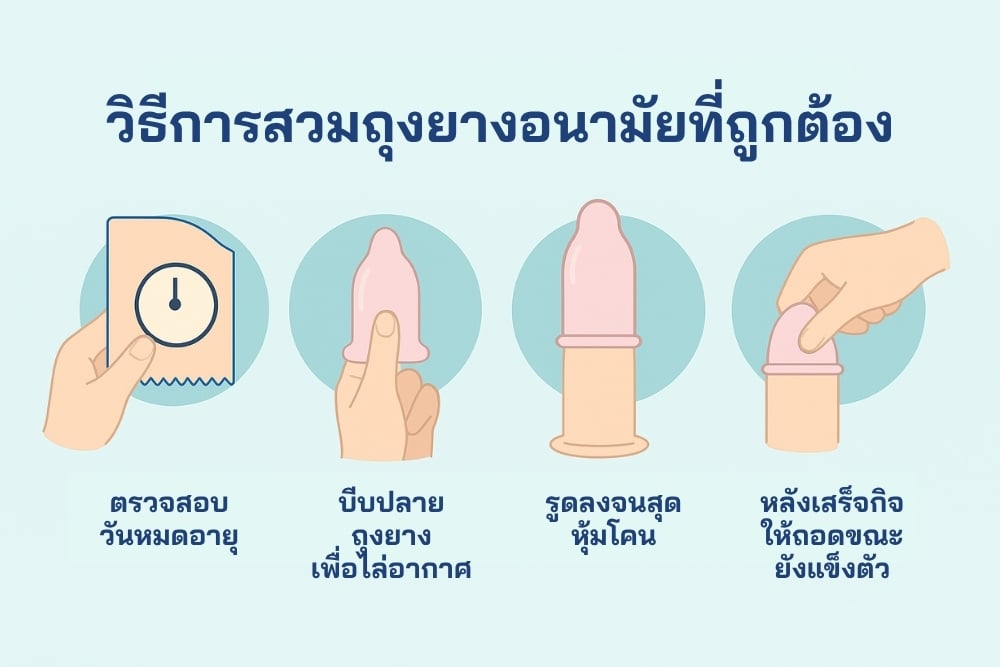 วิธีการสวมถุงยางอนามัยที่ถูกต้อง