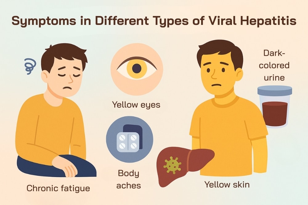Symptoms to Watch for in Different Types of Viral Hepatitis