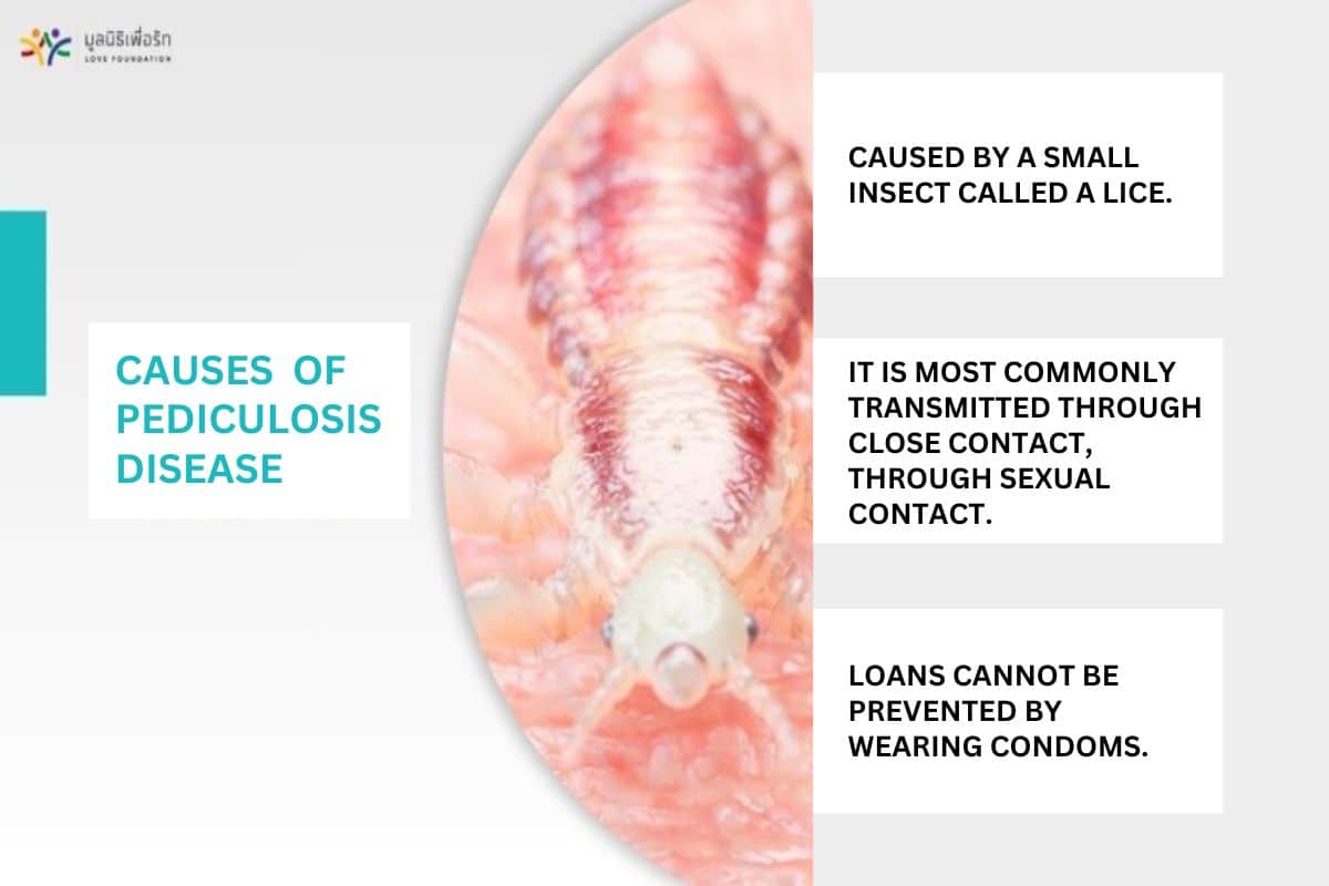 Causes of Pediculosis Disease