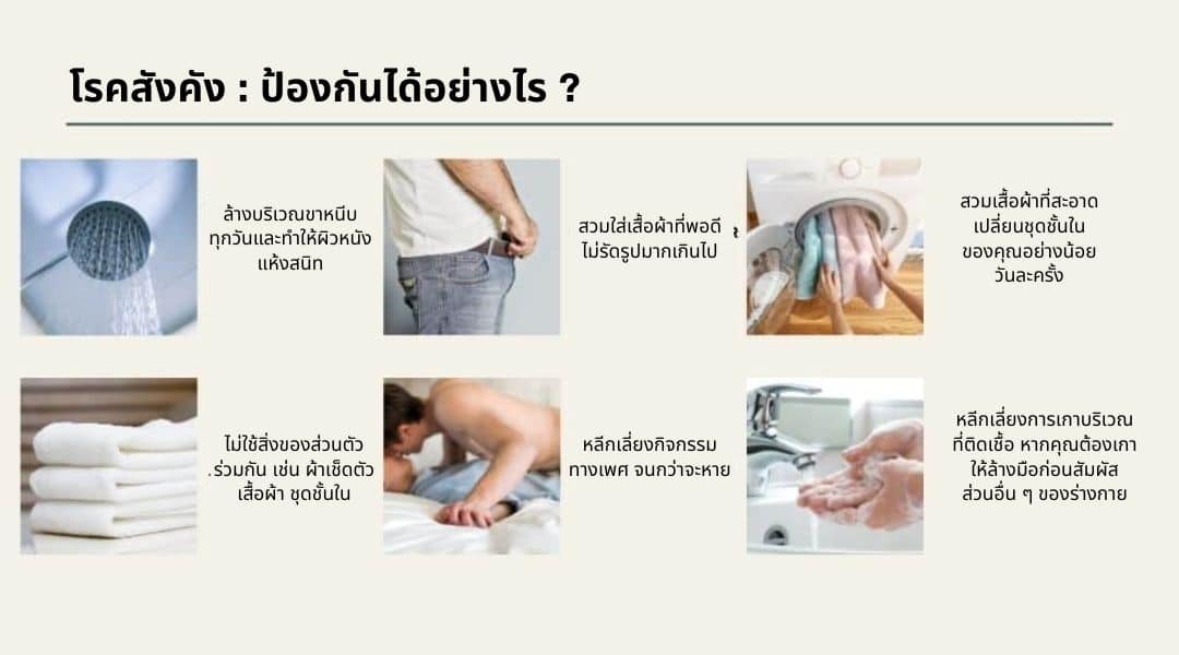 วิธีป้องกัน โรคสังคัง