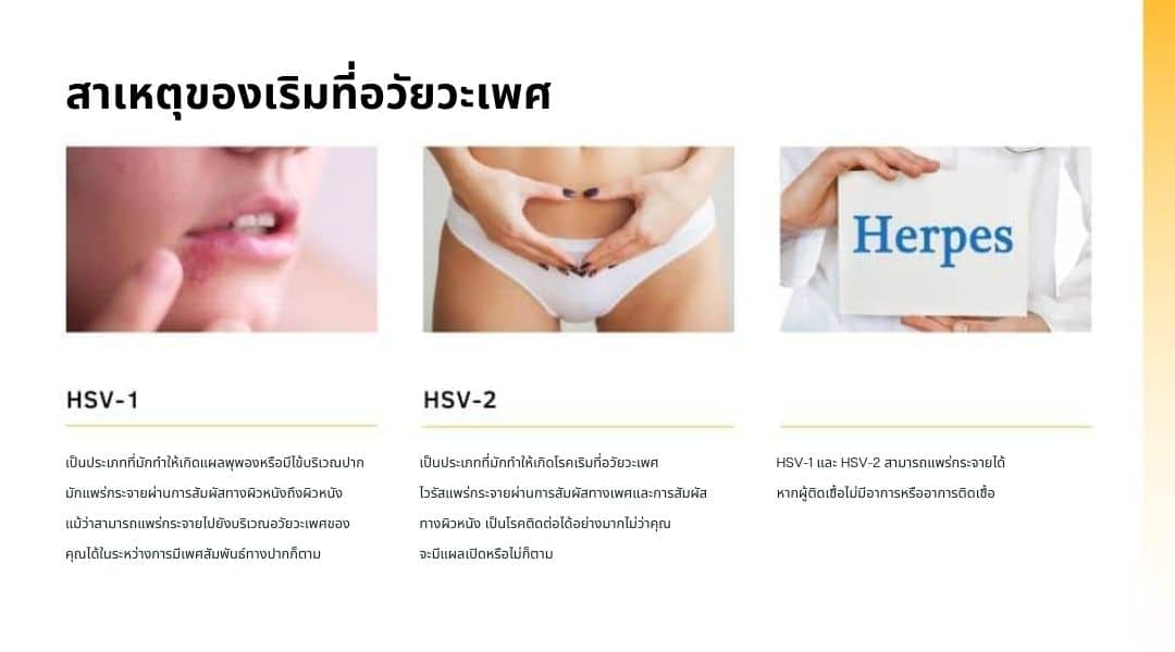 สาเหตุของเริมที่อวัยวะเพศ
