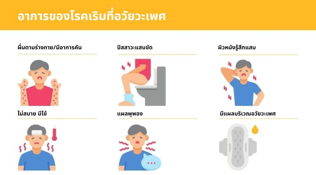 อาการของ เริม ที่อวัยวะเพศ