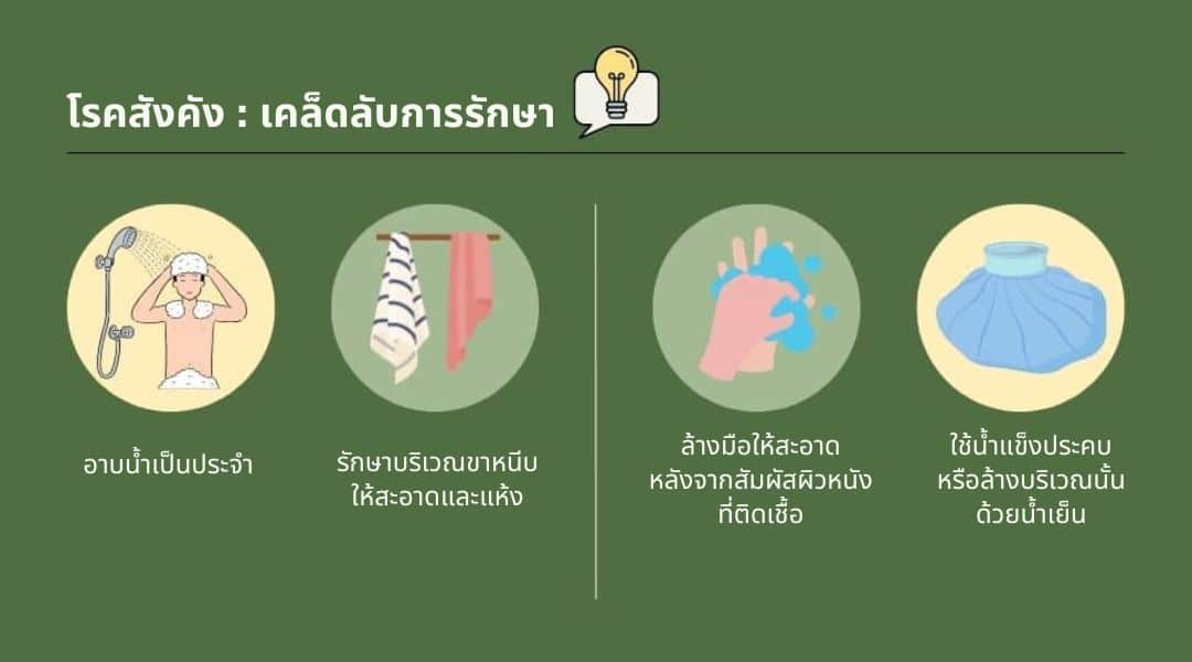 โรคสังคัง เคล็ดลับการรักษา