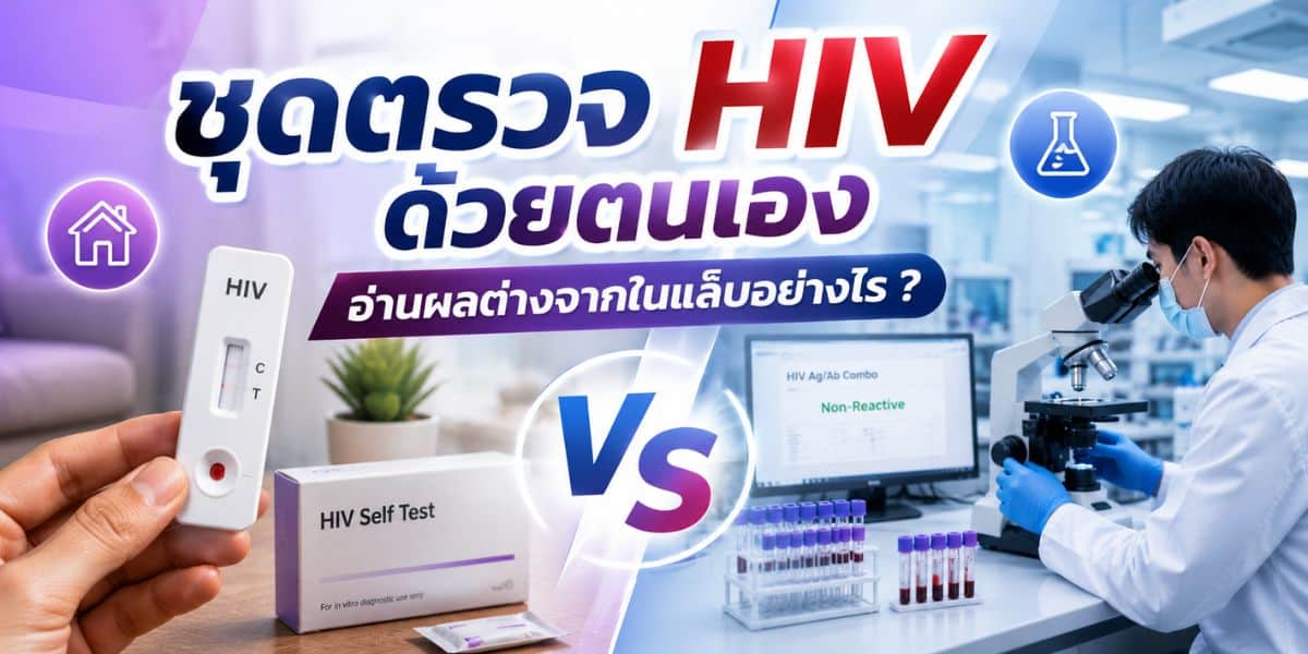 How to read an HIV self-test compared with a laboratory test