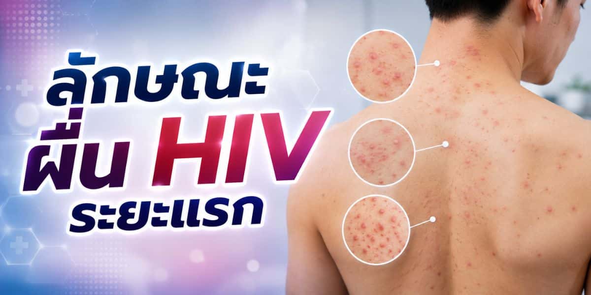 Characteristics of HIV rash in the early stage