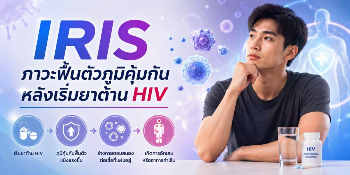 IRIS: Immune Recovery After Starting HIV Treatment
