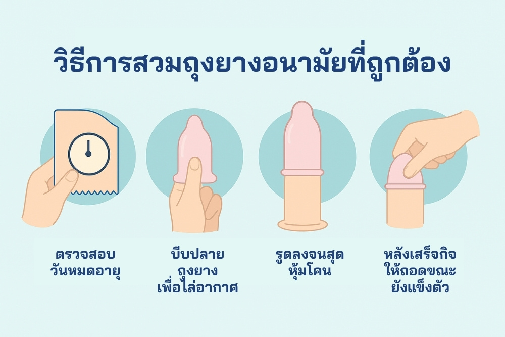 วิธีการสวมถุงยางอนามัยที่ถูกต้อง