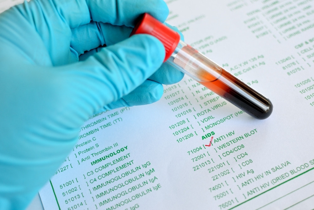 วิธีตรวจเอชไอวี แบบไหนเหมาะกับคุณ HIV Testing Methods