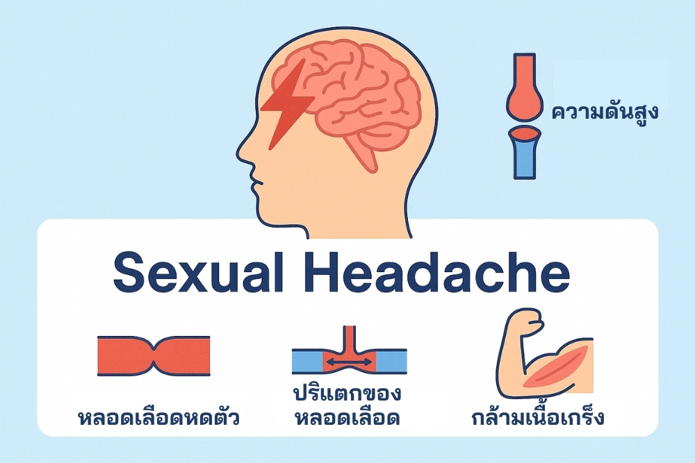 สาเหตุของอาการ Sexual Headache