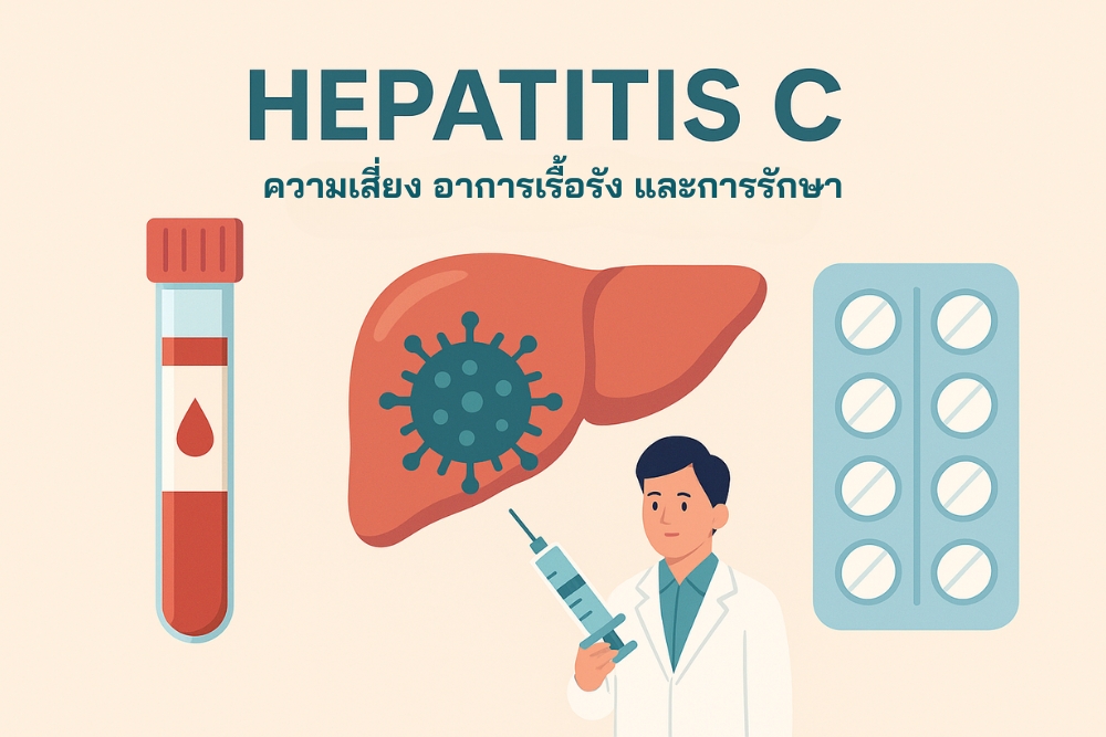 ไวรัสตับอักเสบ ซี ความเสี่ยง อาการเรื้อรัง และการรักษาสมัยใหม่