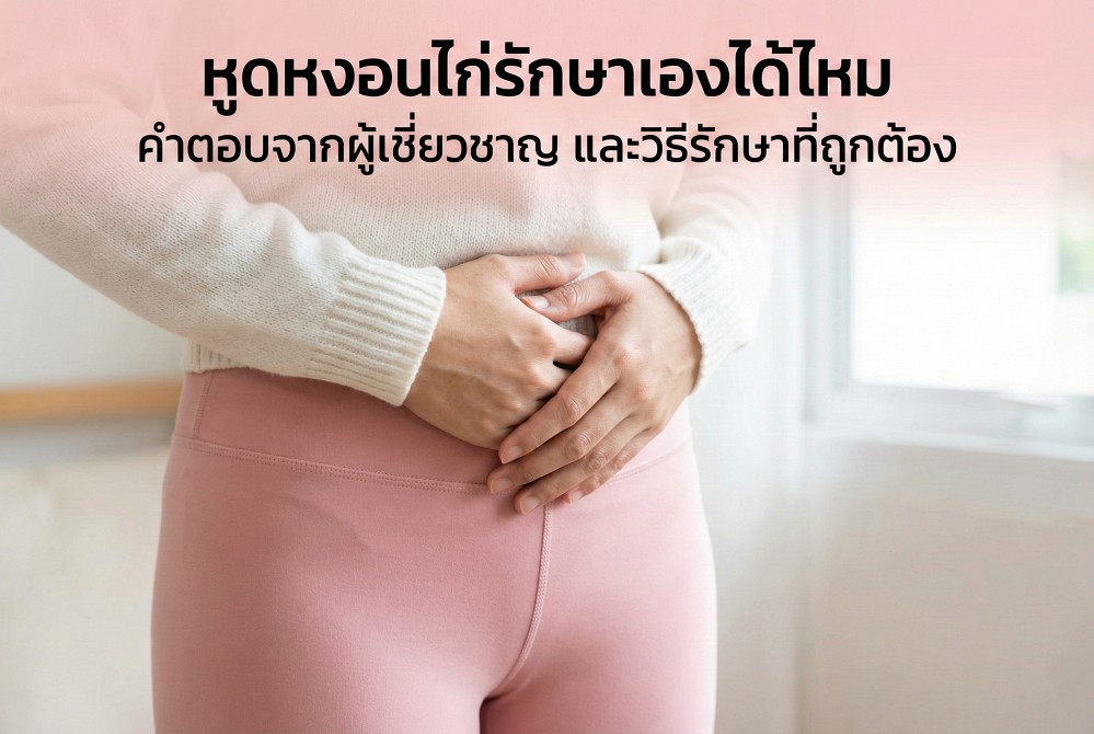 หูดหงอนไก่รักษาเองได้ไหม คำตอบจากผู้เชี่ยวชาญ และวิธีรักษาที่ถูกต้อง