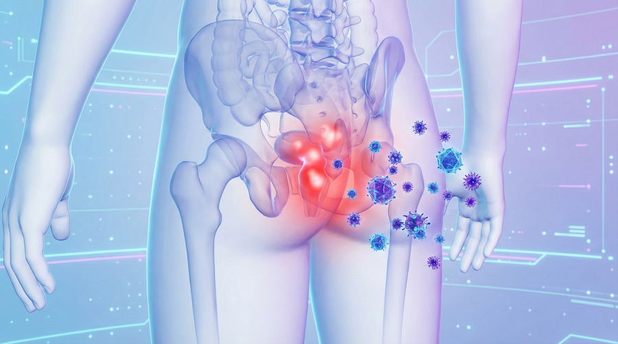 การป้องกันโรค ฝีทวารหนัก