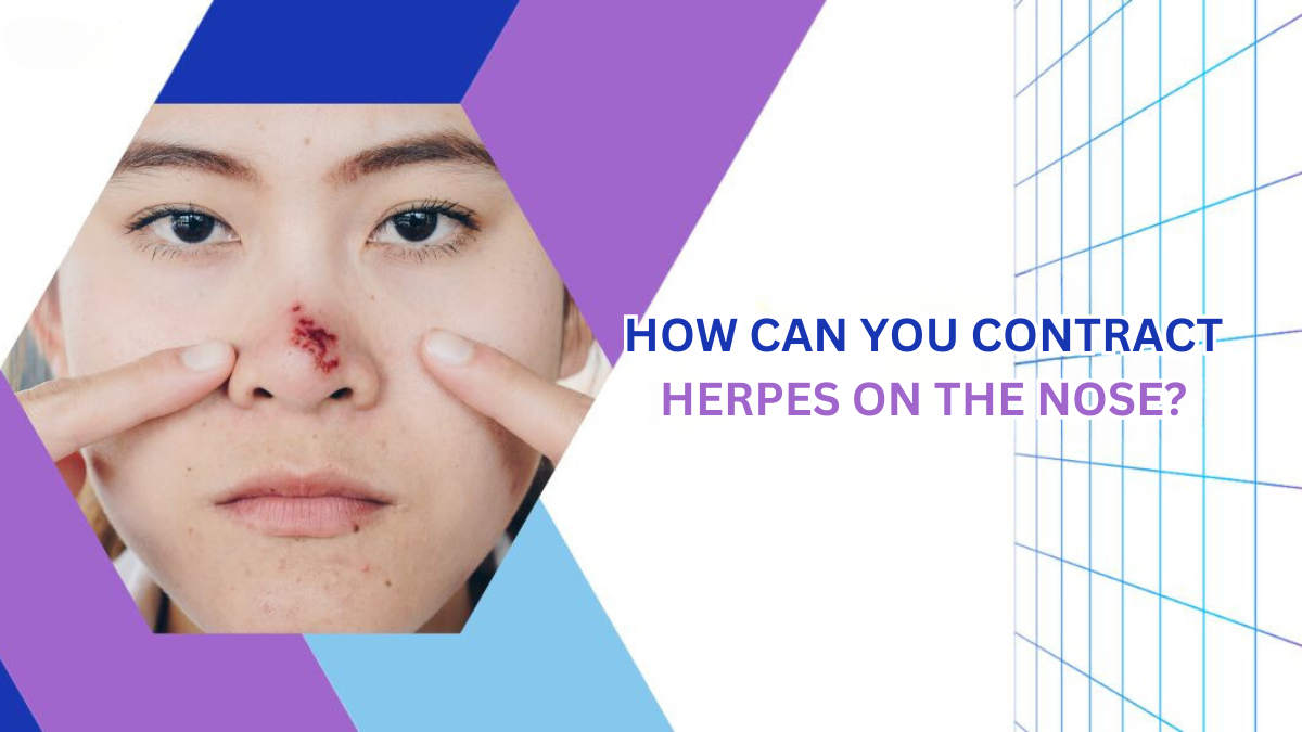 How Can You Contract Herpes on the Nose