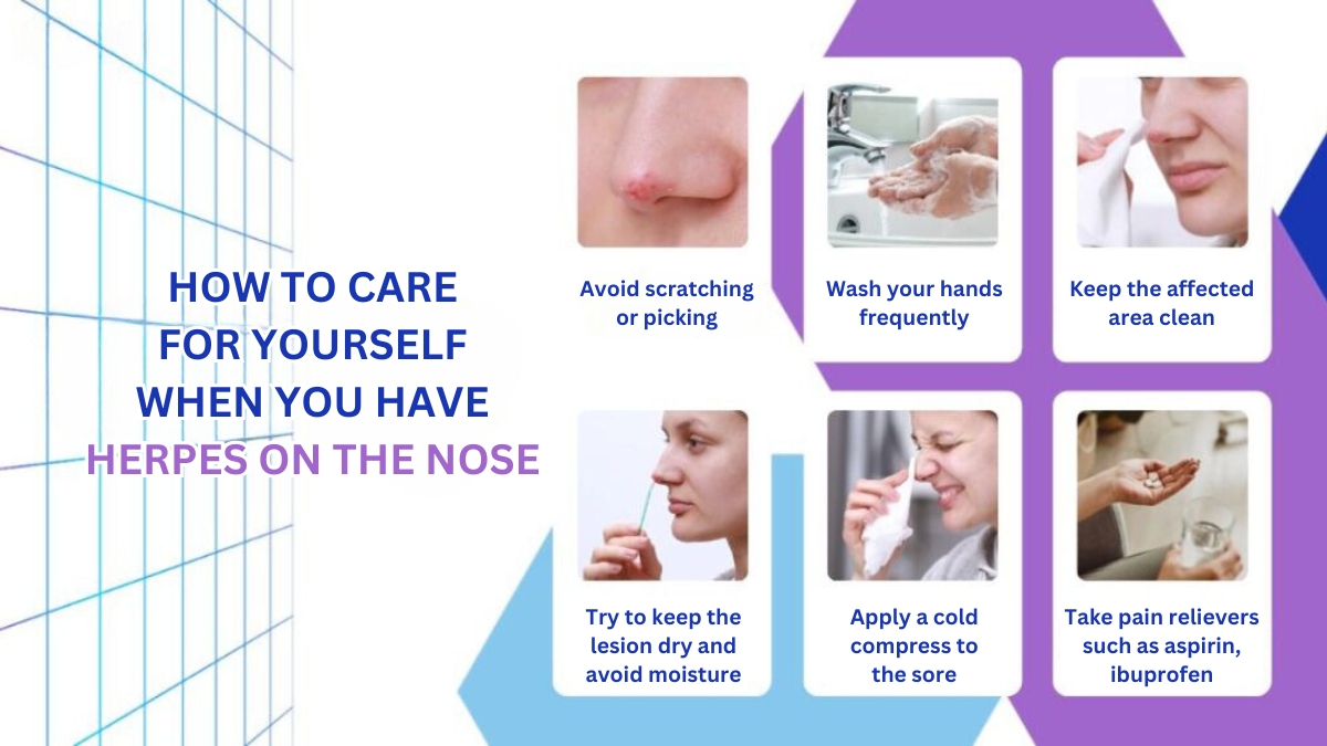 How to Care for Yourself When You Have Herpes on the Nose