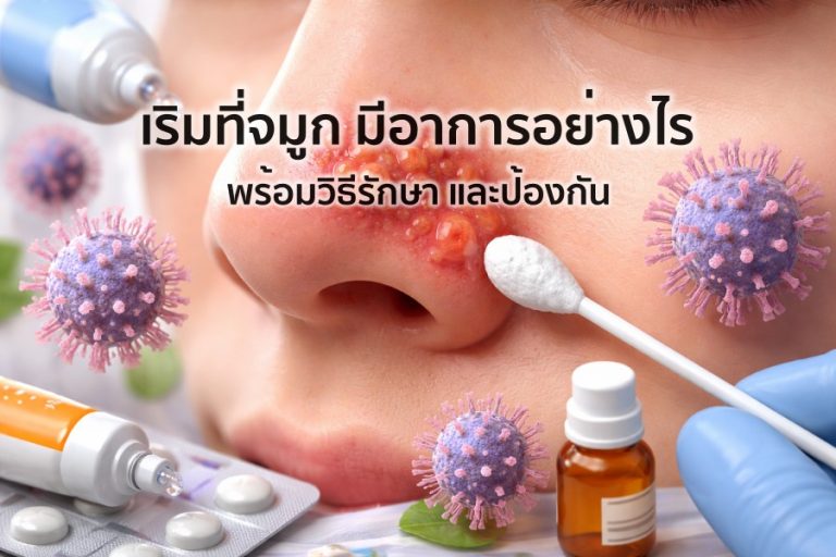 เริมที่จมูก มีอาการอย่างไร พร้อมวิธีรักษา และป้องกัน