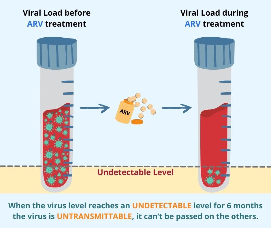 ARV treatment