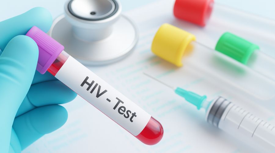 ตรวจเอชไอวี จำเป็นหรือไม่ ขึ้นอยู่กับพฤติกรรมเสี่ยงของคุณ