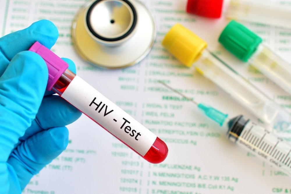 ตรวจเอชไอวี จำเป็นหรือไม่ ขึ้นอยู่กับพฤติกรรมเสี่ยงของคุณ HIV Testing Explained