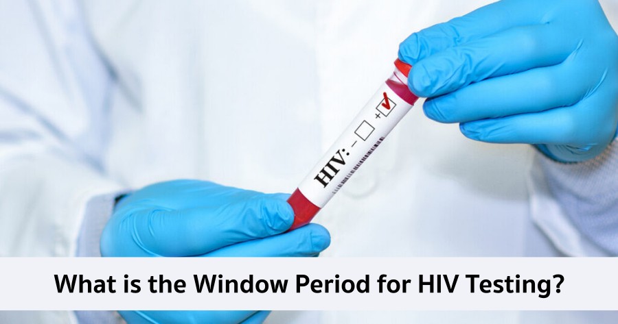 What is the window period for HIV testing