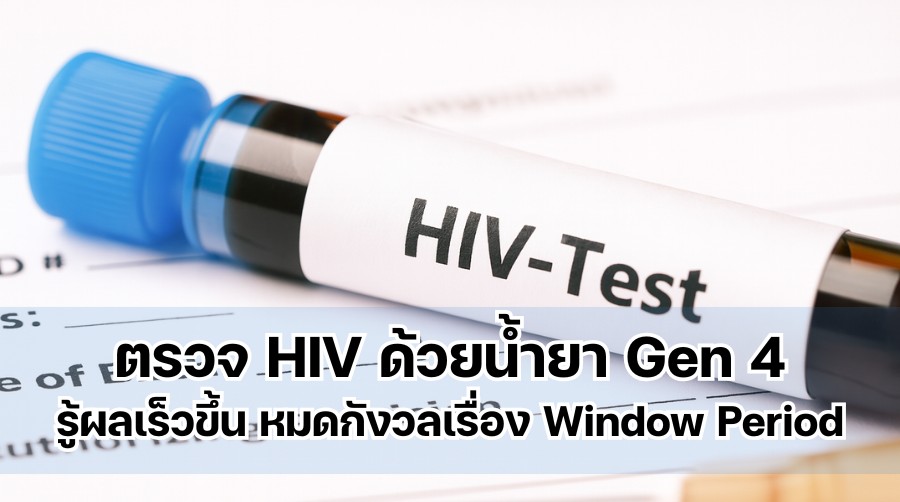 ตรวจ HIV ด้วยน้ำยา Gen 4 รู้ผลเร็วขึ้น