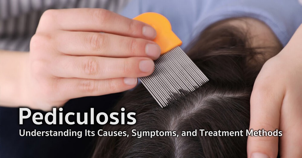 Pediculosis: Understanding Its Causes