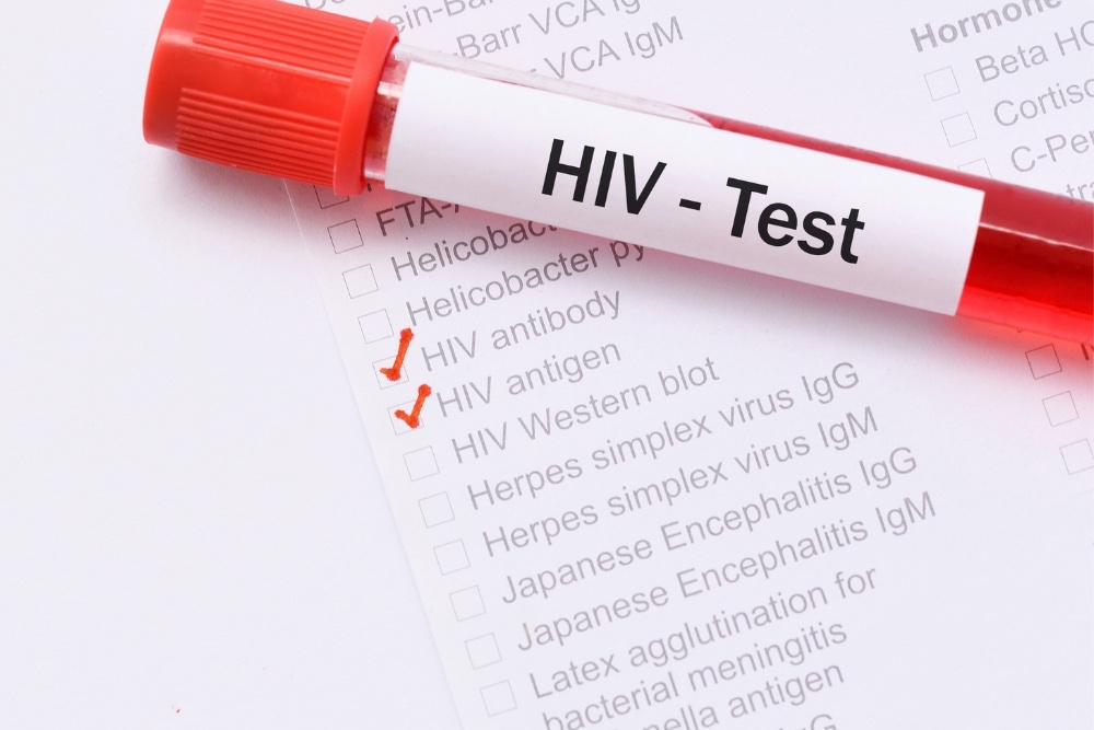 คนไทยตรวจ HIV ฟรี ที่ไหนบ้าง?