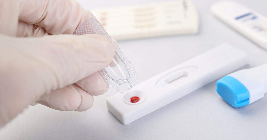 ชุดตรวจ HIV Self-Test