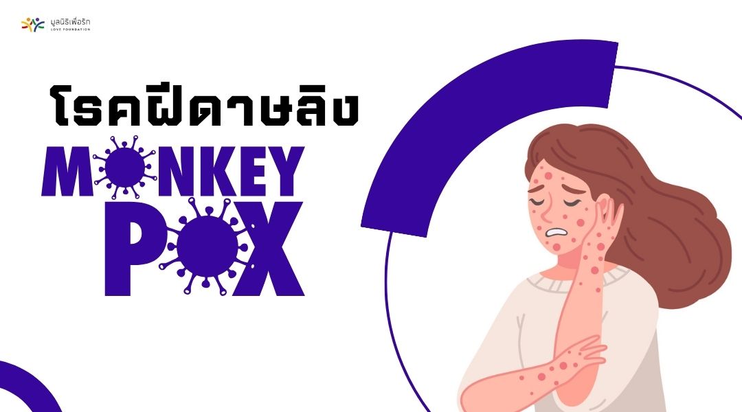 โรคฝีดาษลิง (Monkeypox) (1)