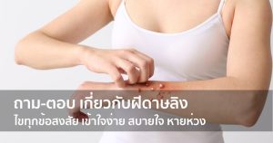 ถาม-ตอบ เกี่ยวกับฝีดาษลิง ไขทุกข้อสงสัย เข้าใจง่าย สบายใจ หายห่วง