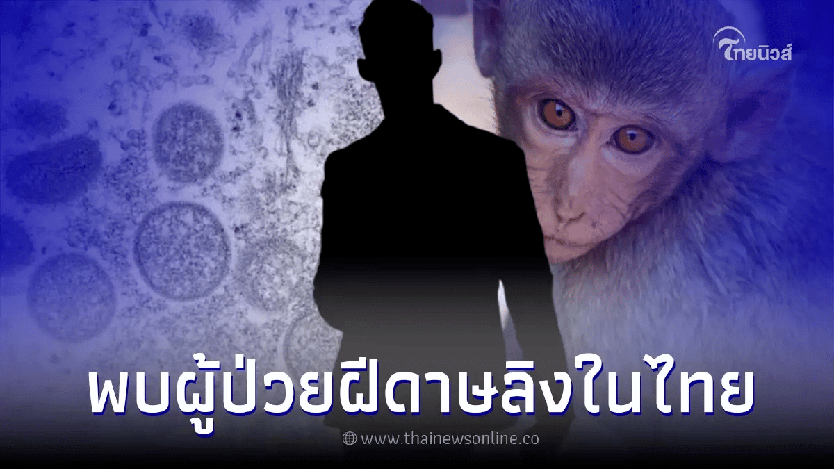 ข่าวฝีดาษลิง 21 กรกฎาคม 2565 - กรมควบคุมโรคยืนยันพบ "ฝีดาษลิง" รายแรกในไทย