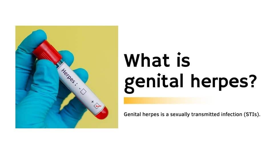 What is genital herpes