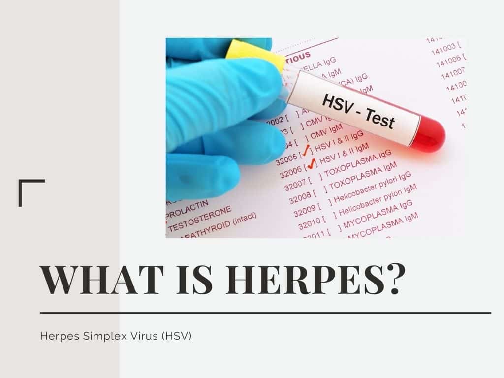 What is herpes