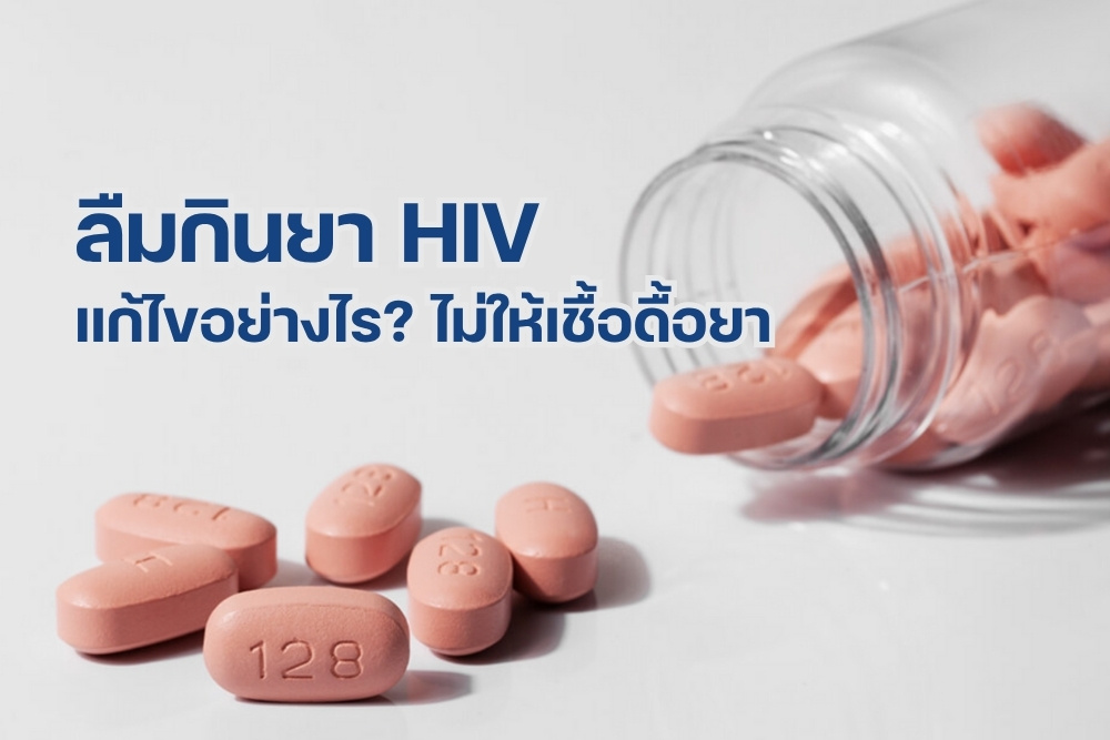 ลืมกินยา HIV แก้ไขอย่างไรไม่ให้เชื้อดื้อยา