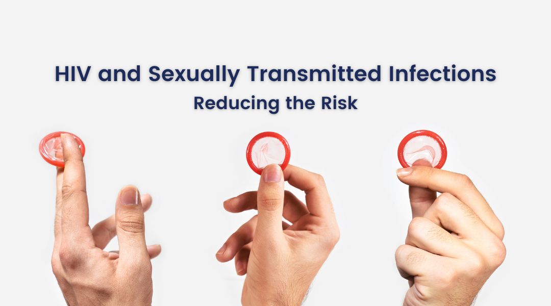 HIV and Sexually Transmitted Infections Reducing the Risk
