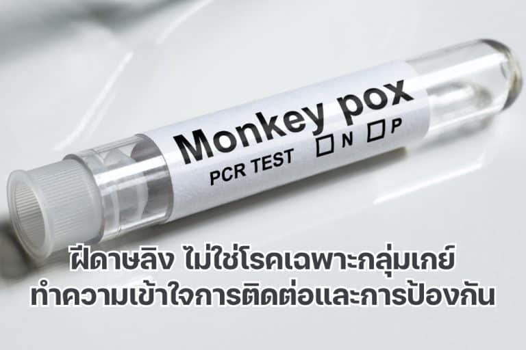 ฝีดาษลิง ไม่ใช่โรคเฉพาะกลุ่มเกย์ ทำความเข้าใจการติดต่อ และการป้องกัน