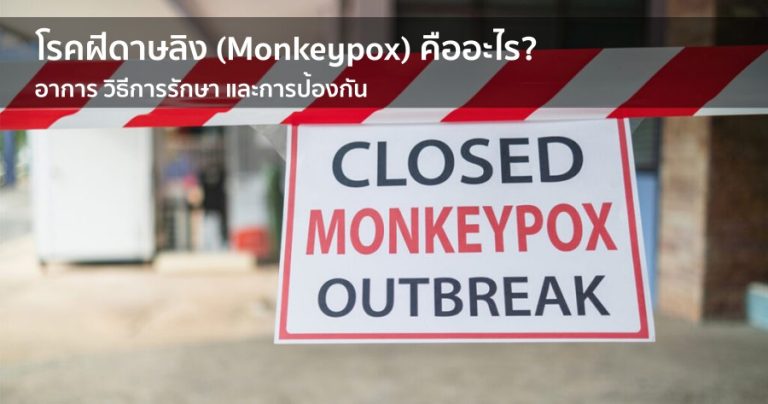 โรคฝีดาษลิง (Monkeypox) คืออะไร อาการ วิธีการรักษา และการป้องกัน