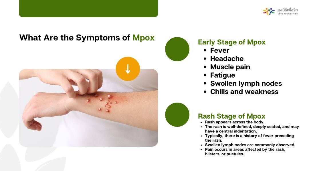 What Are the Symptoms of Mpox