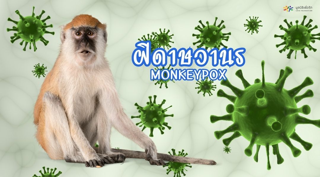 ฝีดาษวานร Monkeypox