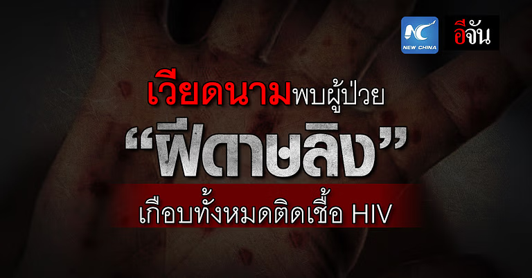 เวียดนาม พบผู้ป่วย “ฝีดาษลิง” เกือบทั้งหมดติดเชื้อ HIV