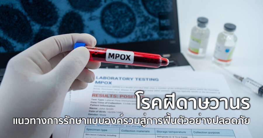 โรคฝีดาษวานร แนวทางการรักษาแบบองค์รวม สู่การฟื้นตัวอย่างปลอดภัย