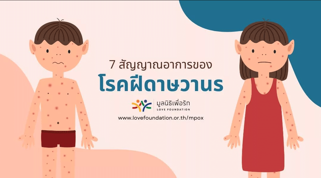 7 สัญญาณอาการของโรคฝีดาษวานร