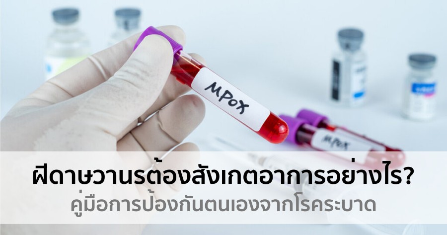 ฝีดาษวานร ต้องสังเกตอาการอย่างไร