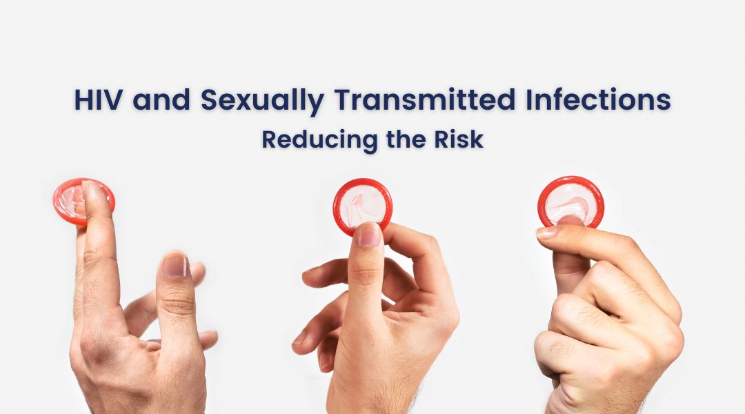 Hiv Transmission Sexually Prevention And Treatment Of HIV And Other