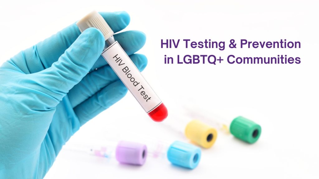 HIV test