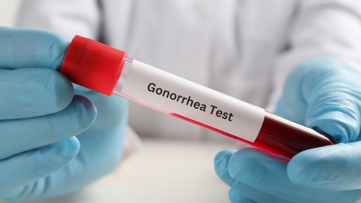 Gonorrhea