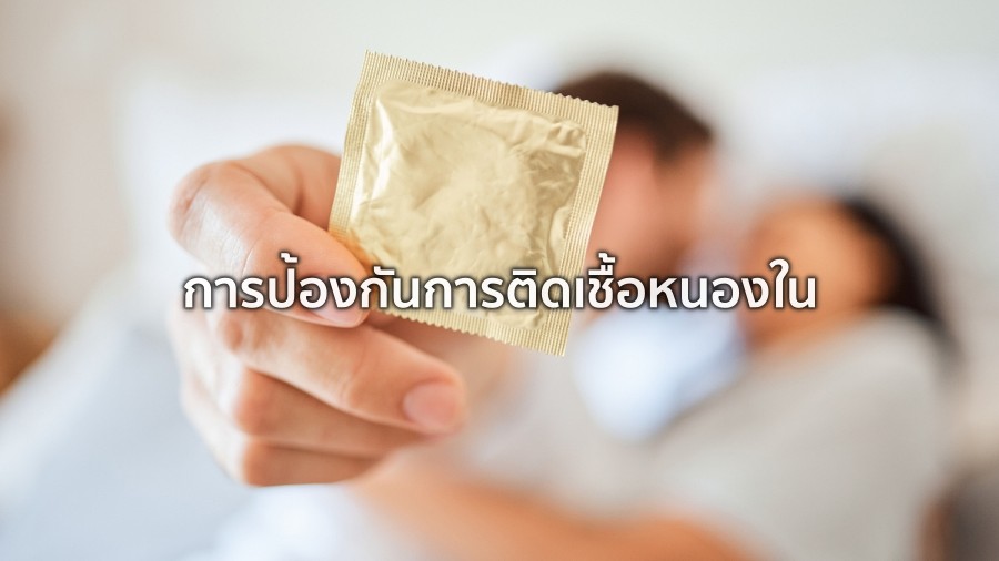 กลยุทธ์การป้องกัน การติดเชื้อหนองใน ในวัยรุ่น