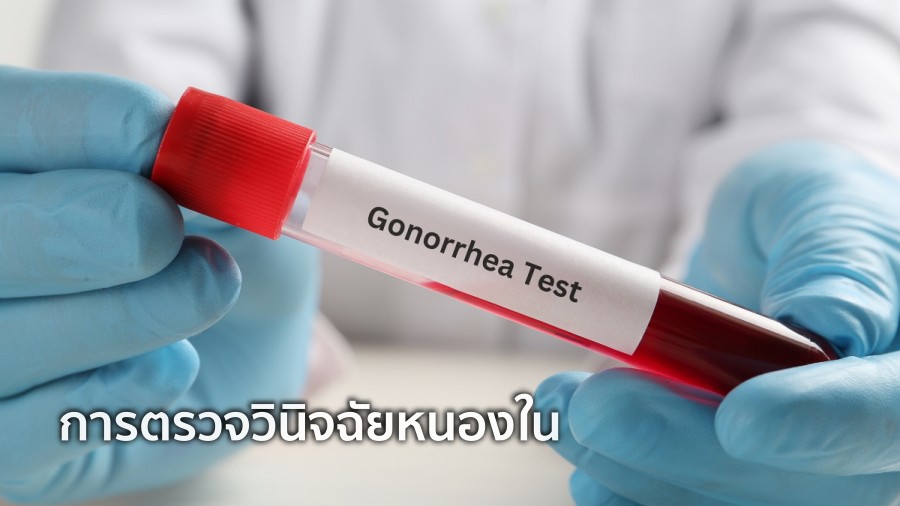 การทดสอบและ การวินิจฉัยหนองใน ในวัยรุ่น